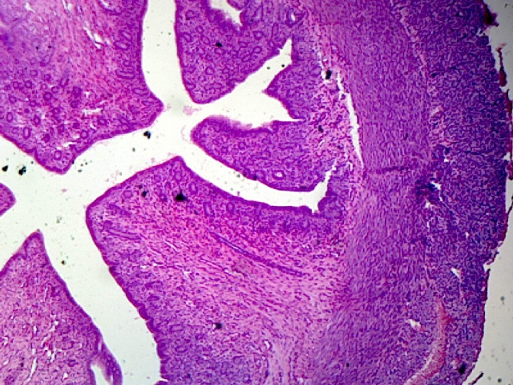 Uterus, Mammalian; Showing General Structures; Section