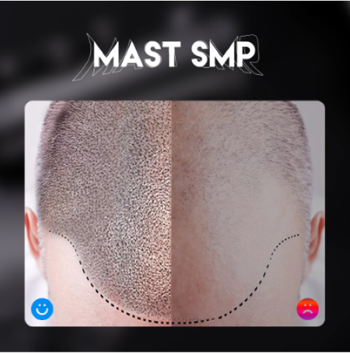 Mast Pro SMP Scalp Micropigmentation Permanent Makeup Machine with Needles &ink