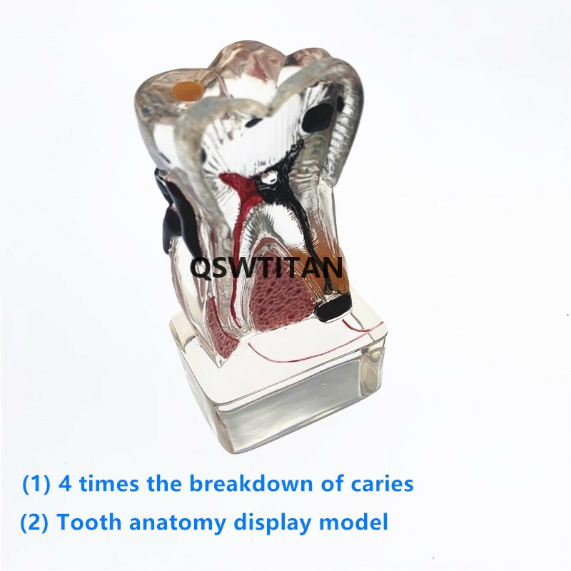 Teeth Model 4 times tooth pathology model Periodontal Teaching Study model