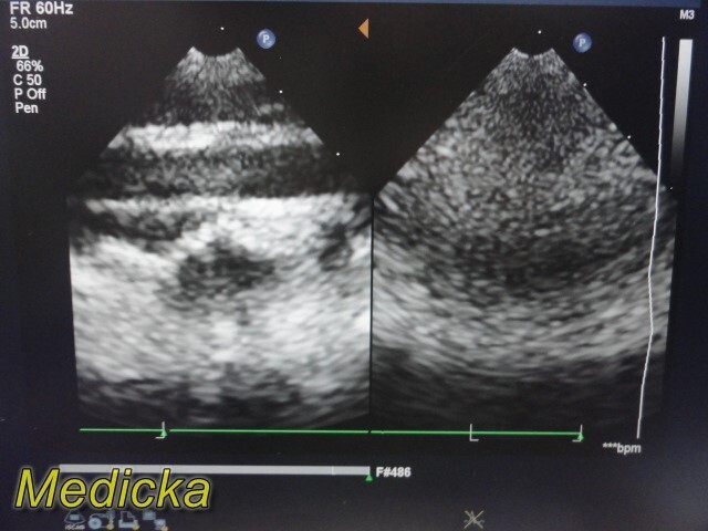Philips X7-2 Matrix Sector Array Ultrasound Transducer Ref 453561192603 ~ 36256