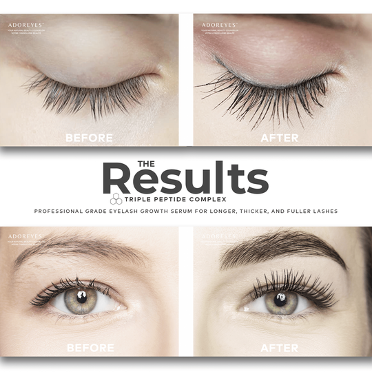 ADOREYES Plus Lashes Eyelash Enhancing Serum with Triple Peptide Complex (6 ml)