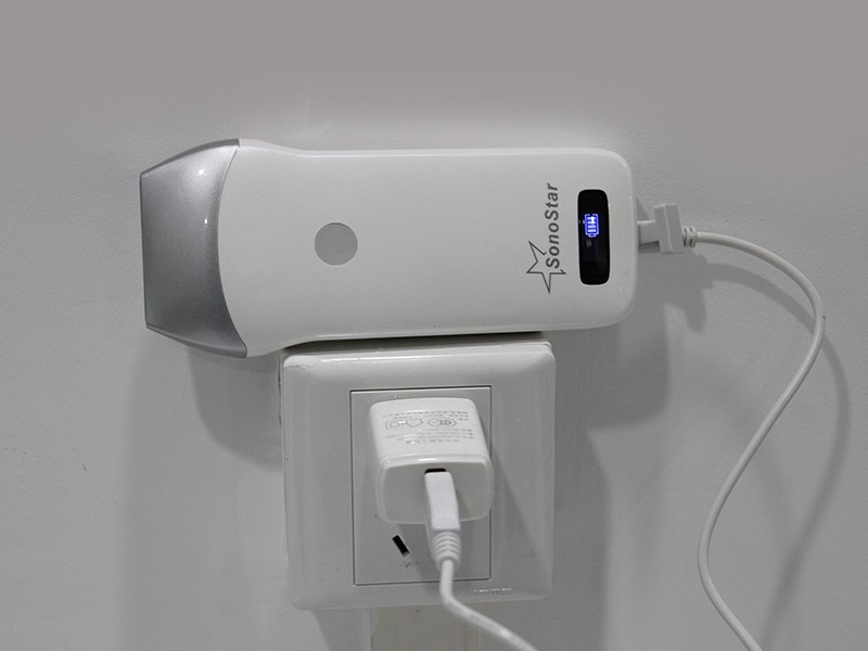 Portable 80 Elements Linear Array Wireless Ultrasound Probe Multi-OS Compatible