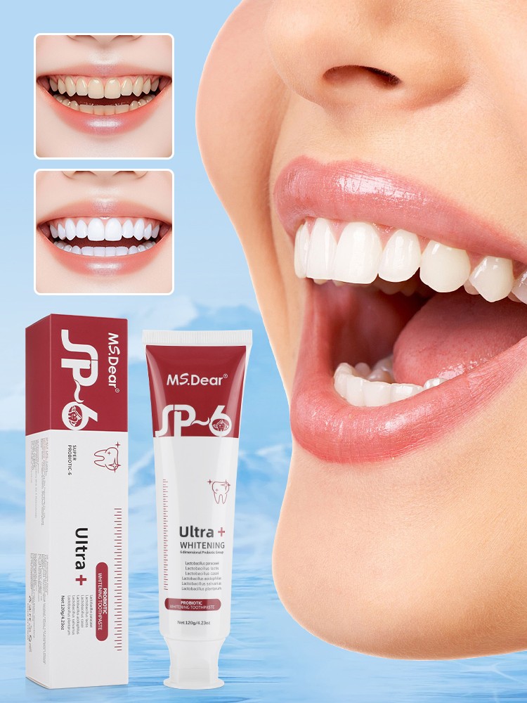 3Pcs Probiotic SP-6 Toothpaste, Super Bright White Toothpaste, Oral Clean Hot