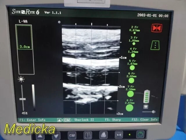 Chison Tech L-VA Linear Array Probe – Vascular Imaging for SR-6 (Tested) ~ 36100