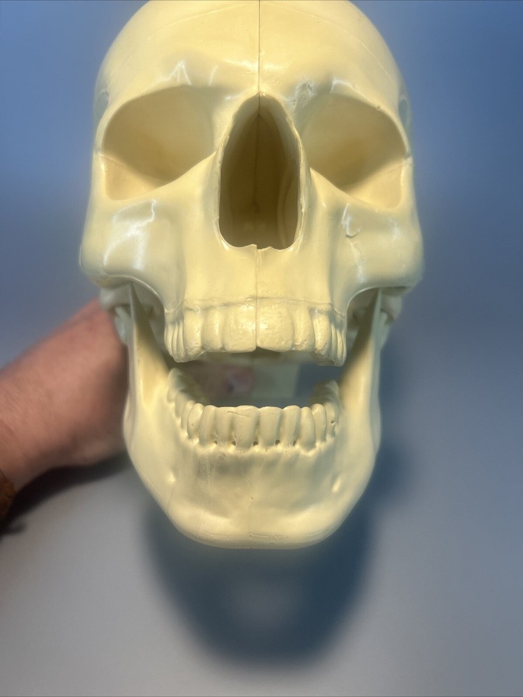 Synbone, Human Skull, Surgical, Training, Education,