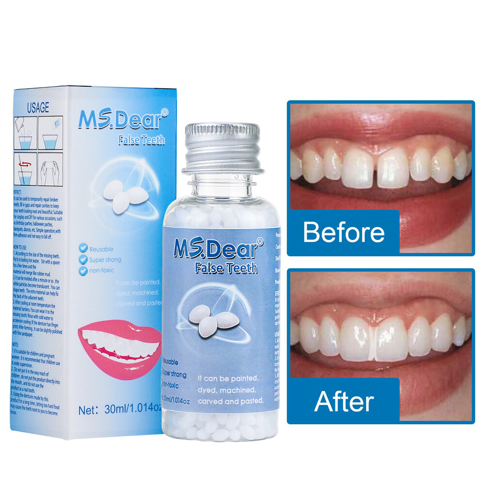 Tooth Repair Granules Temporary Kit Fitting Beads Reusable Moldable False Teeth