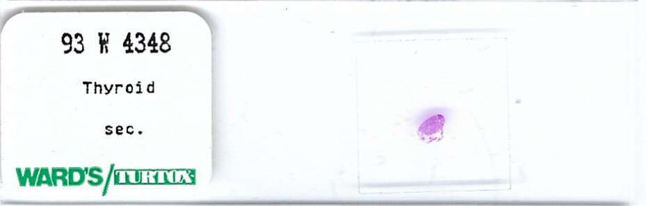 Thyroid Microscope Slide