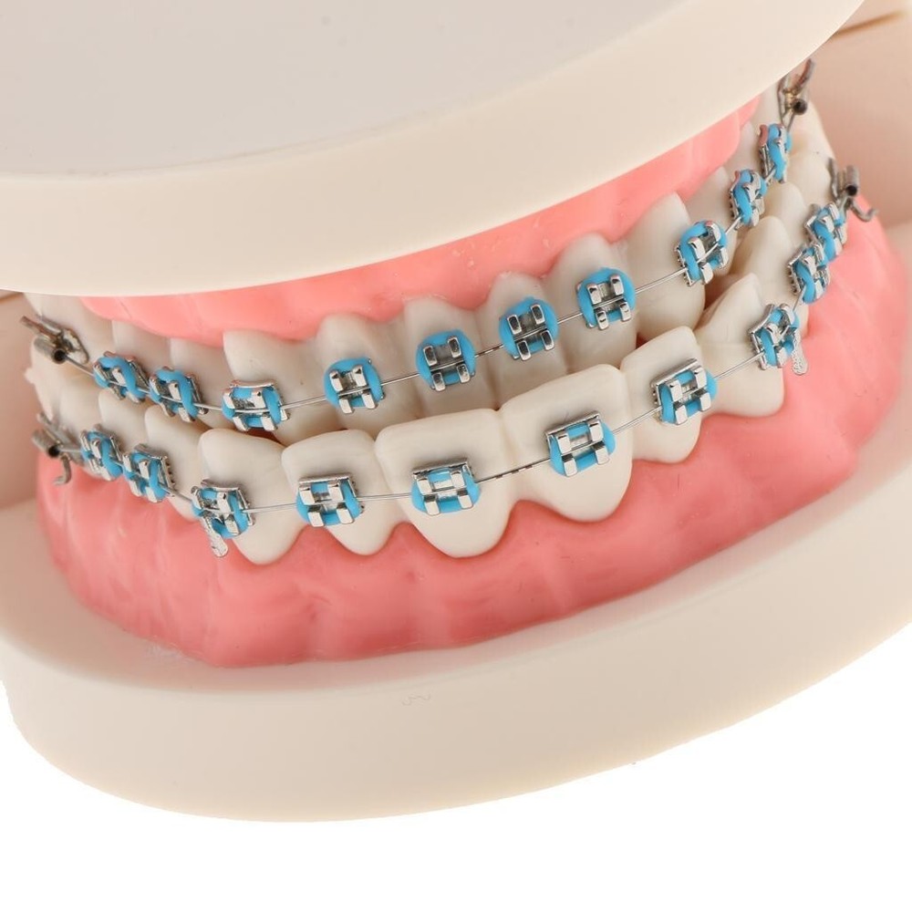Dental Teach Typodont Demonstration Teeth Model with Braces For Patient Study