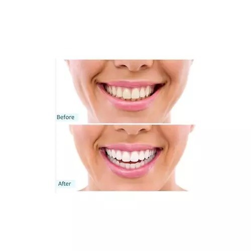 12 Pack Pepsodent Complete Care Anticavity Fluoride Toothpaste Original 5.5 Oz