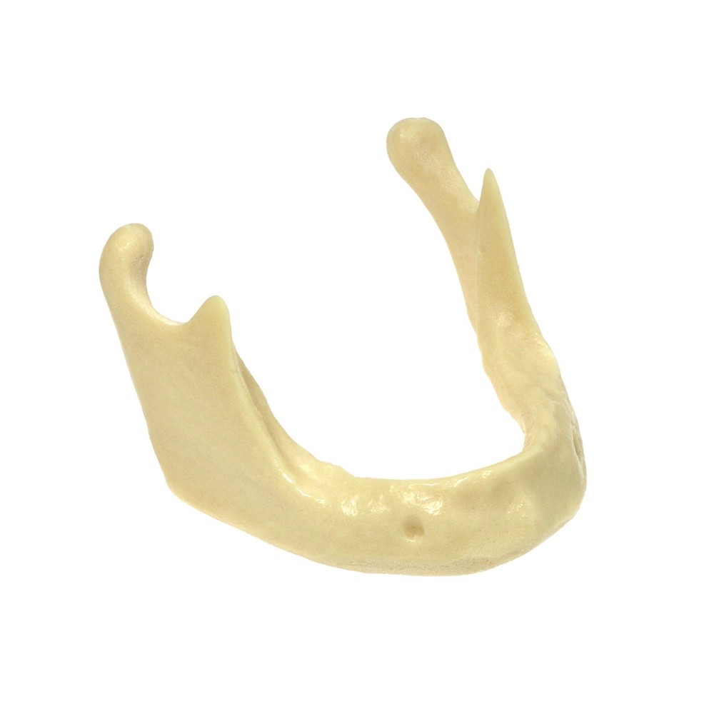 Dental Implant Jaw Bone Model For Practice Basic Drilling Insertion M2022/2023
