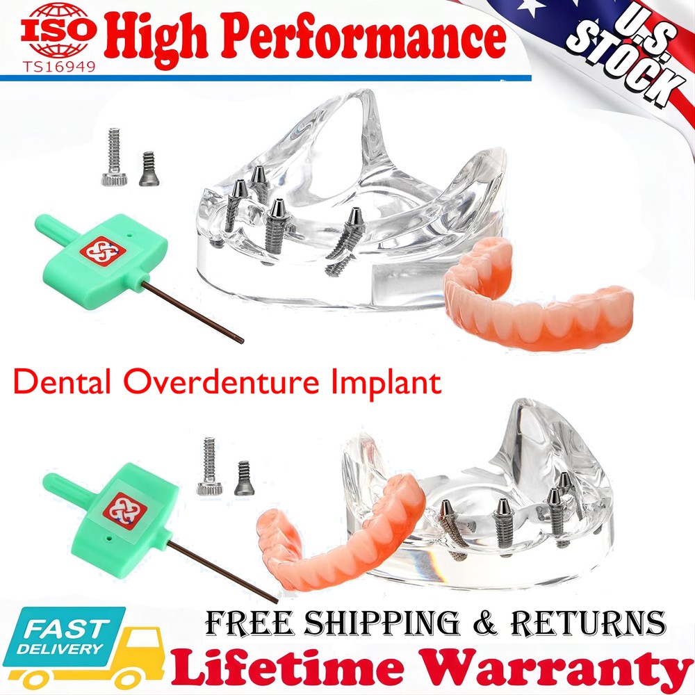 Dental Upper/Lower 4 Implants Demo Implant Teeth Model Restoration Overdenture