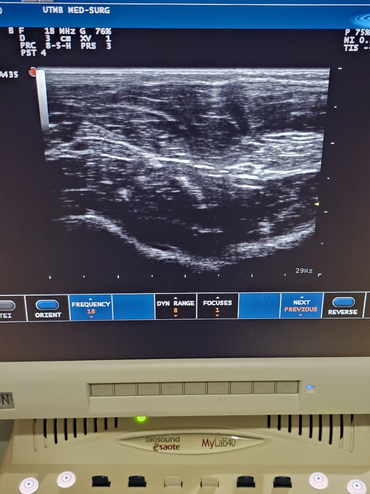 Esaote LA435 Linear Array Ultrasound Transducer Ref 9600173000