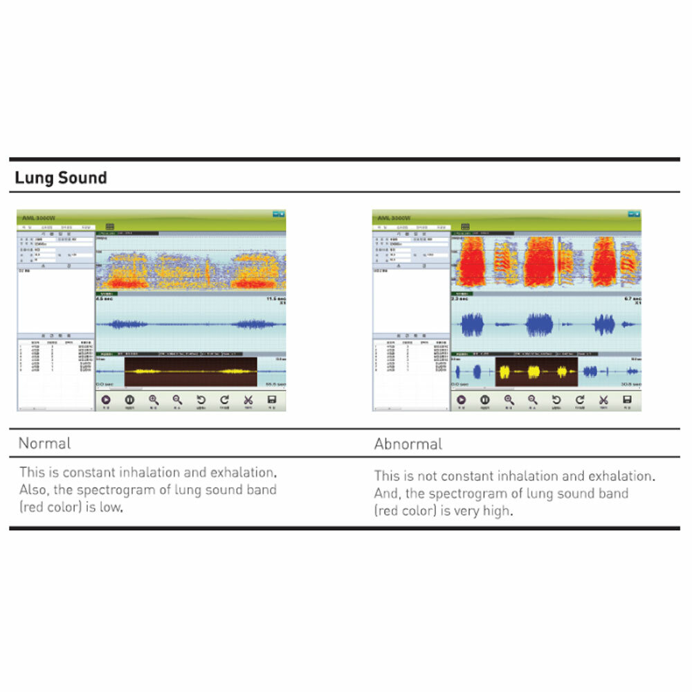 Sunmeditec Animal Wireless Digital Stethoscope