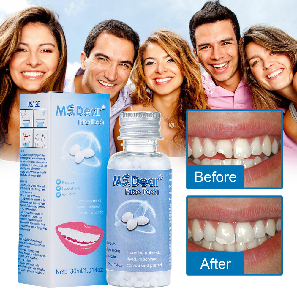 2X Temporary Missing Tooth Repair Kit Teeth And Gaps Solid Glue Denture Adhesive