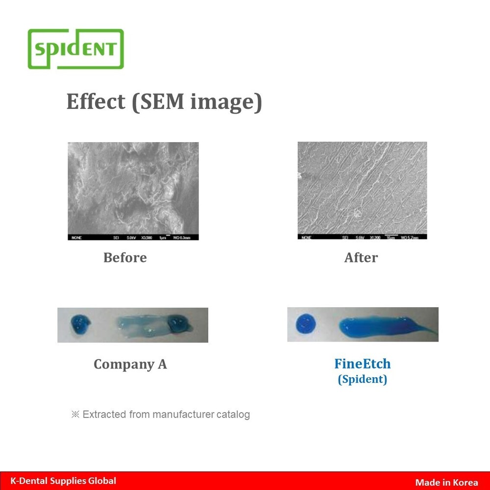 Spident FineEtch(37% Etching Gel) 5ml x 3ea