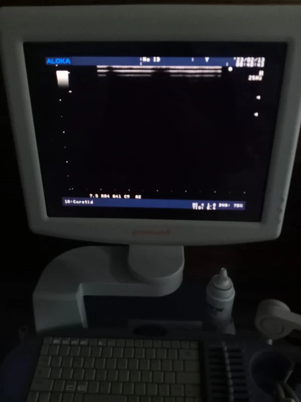 ..aloka UST-5546 linear probe checked dxb