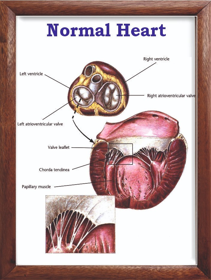 Normal Heart Chart 12x18 inches