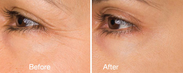 DIY 100% Argireline Copper Peptide Solution Booster + Matrixyl 3000, SNAP-8,