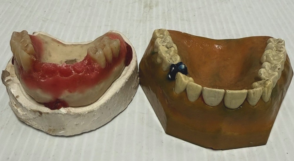 Lot of 2 typodont educational teeth