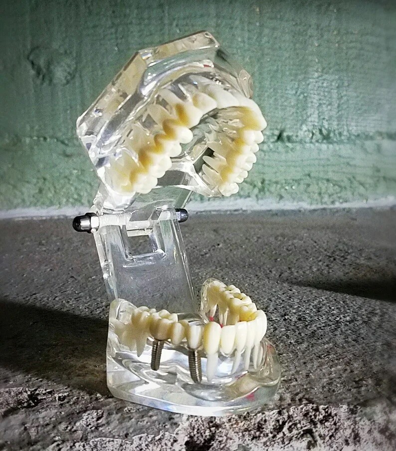 Dental Consultation Model