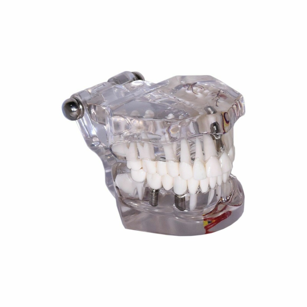 Redland B5-06 Dental Demonstration Teeth Educational Model