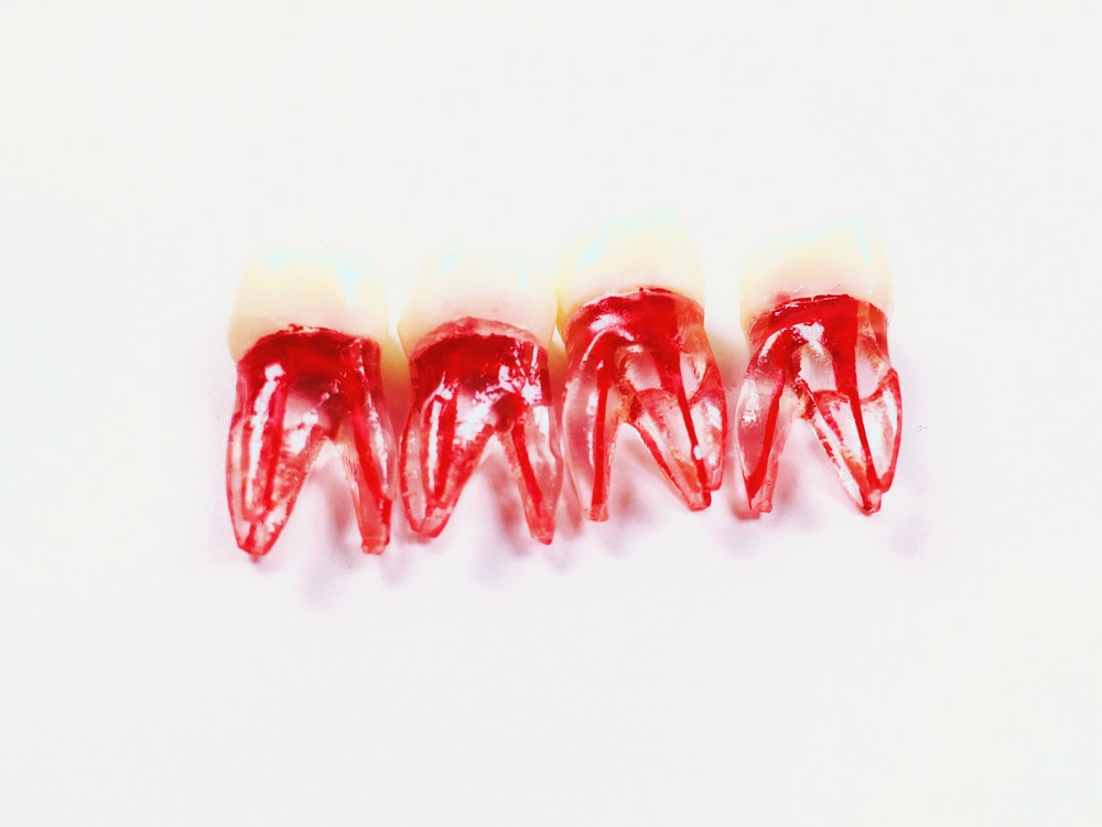 Dental Endo Root Canal File Training Study Model Student Practice Block Red Pulp