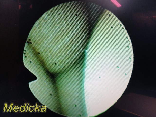 Olympus CHF-CB30S Fiber Optic Choledoscope Flex-Endoscope Read