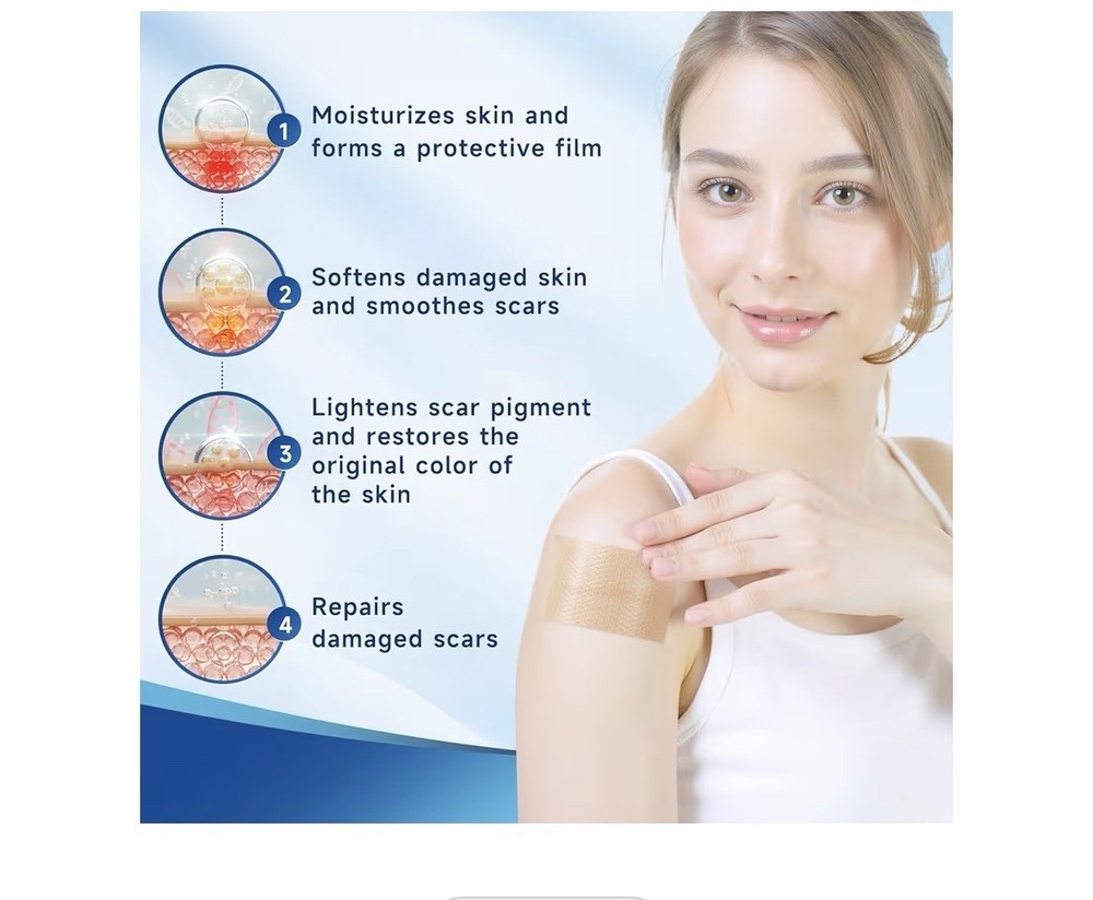 Silicone Scar Sheets, Silicone Scar Tape