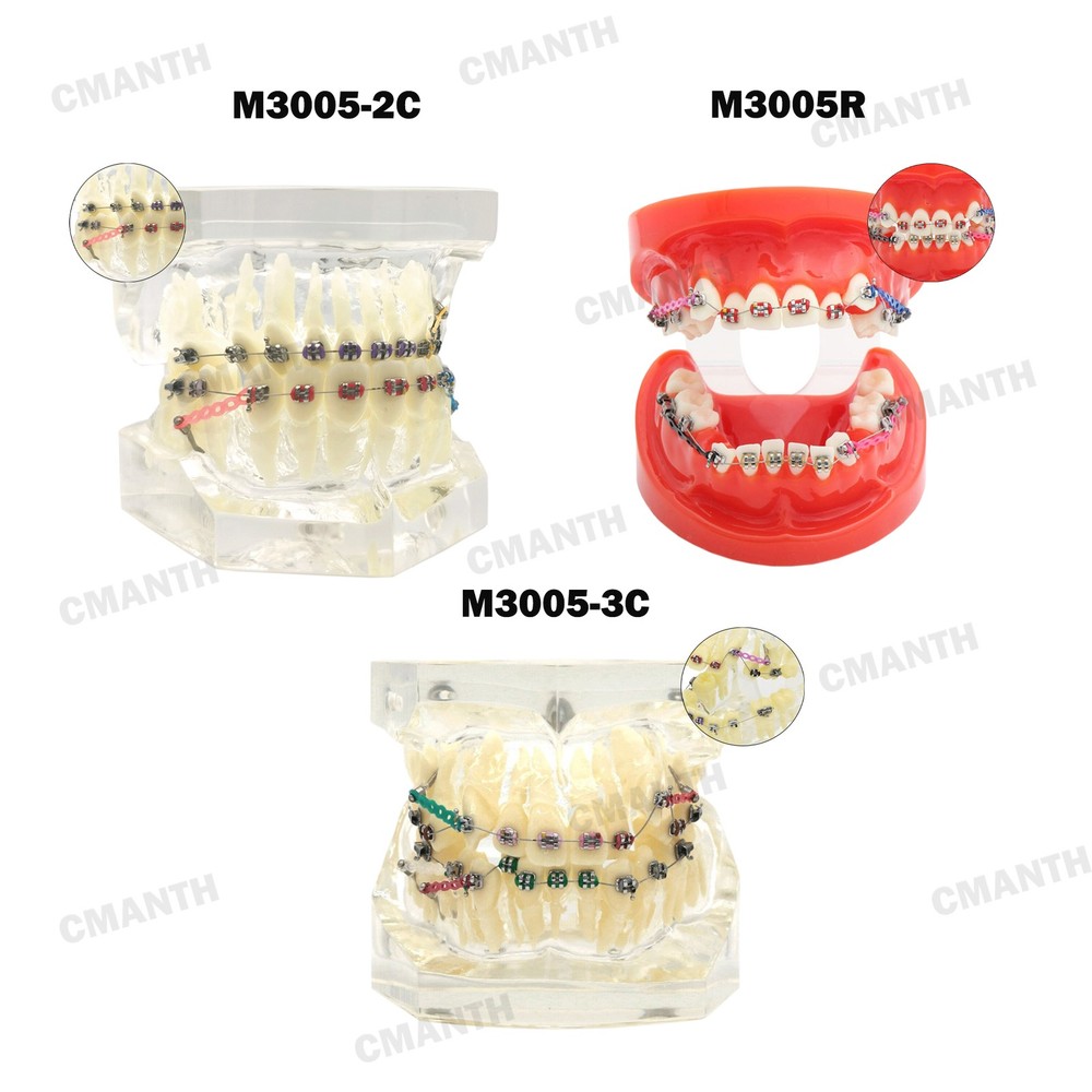 Dental Teeth Model Ceramic Brackets Orthodontic Correction Teaching Model M3005