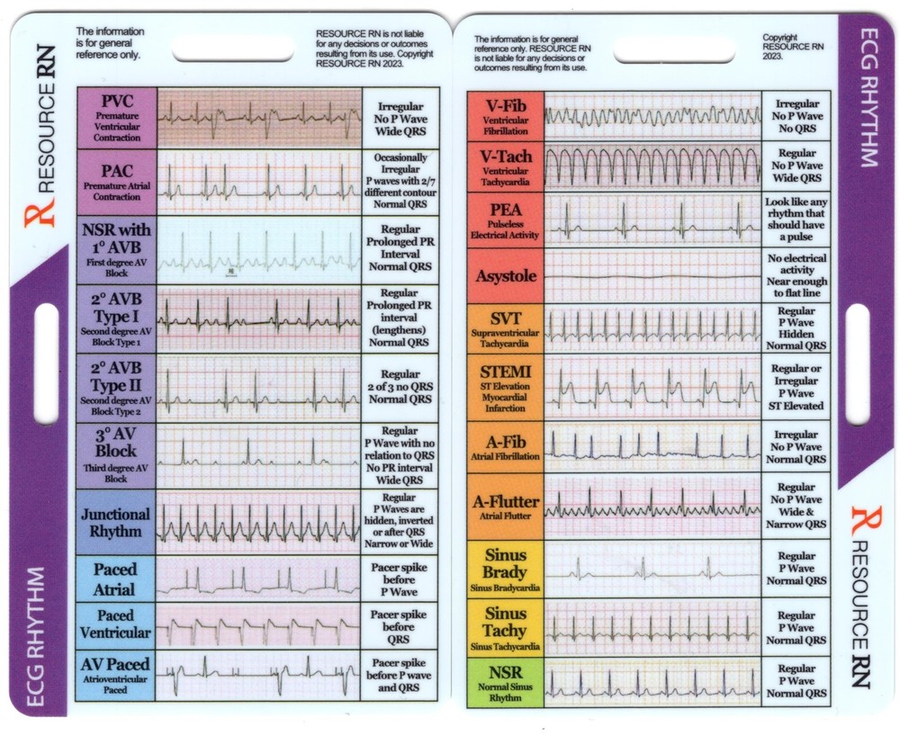 EKG Rhythm Interpretation - Compact & Portable Reference Card – Rapid Interpr...