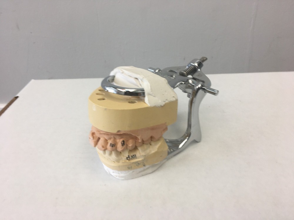 Dental Model, Typodont, Mounted on an Articulator.