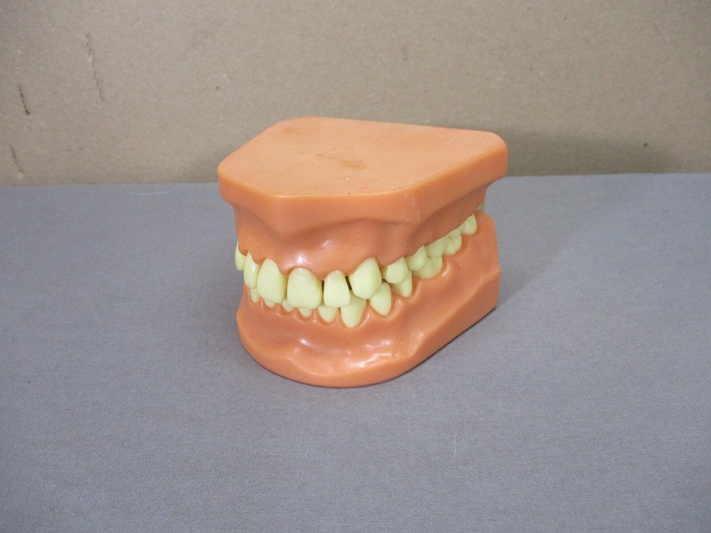 Dentist Typodont Dentoform Dental Model Teeth Overbite Tooth Display Hinged Set