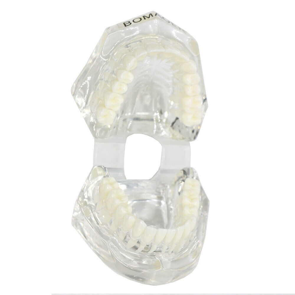 1×Transparent Plastic Study Teeth Model Demonstrate Comprehensive Repair Yellow