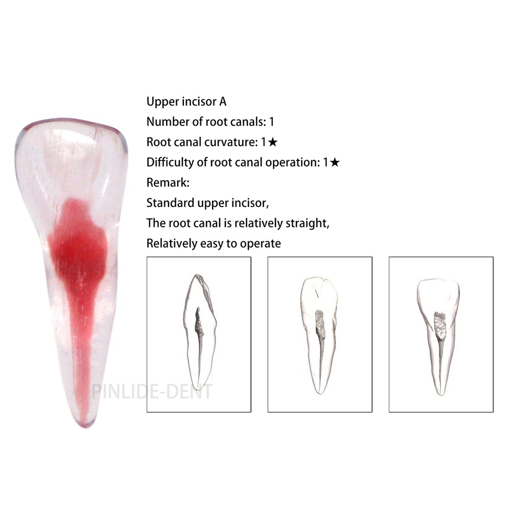 Dental Resin Root Canal Teeth Model Endo Practice Block RCT Pulp Cavity Study