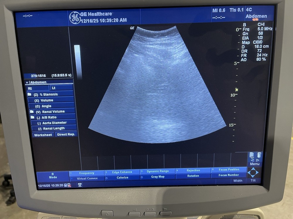 GE 4C Convex Array Ultrasound Transducer Probe -