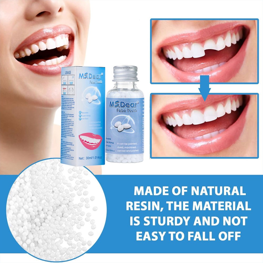 3X Tooth Repair Kit - Temporary Teeth Replacement Kit for Missing & Broken Teeth