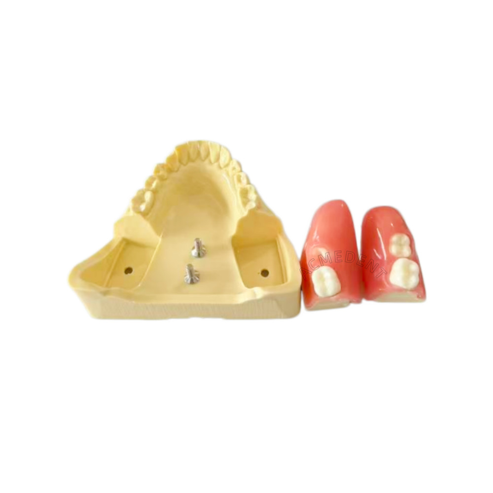 Dental Impacted Tooth Extraction Practice Model Wisdom Teeth Training Students