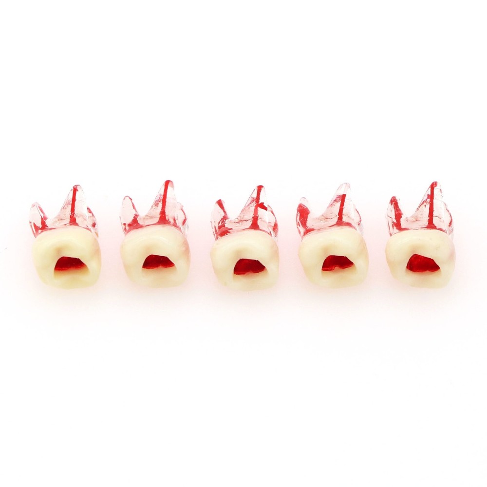 Dental Molar Endo Root Canal Teeth Modle- Study RCT Practice Block Pulp Cavity
