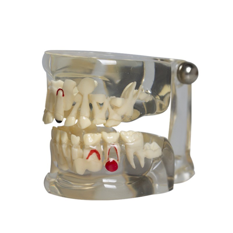 Dental Teeth Model Demo 3-12 Child Permanent Tooth Alternate Developement Proces