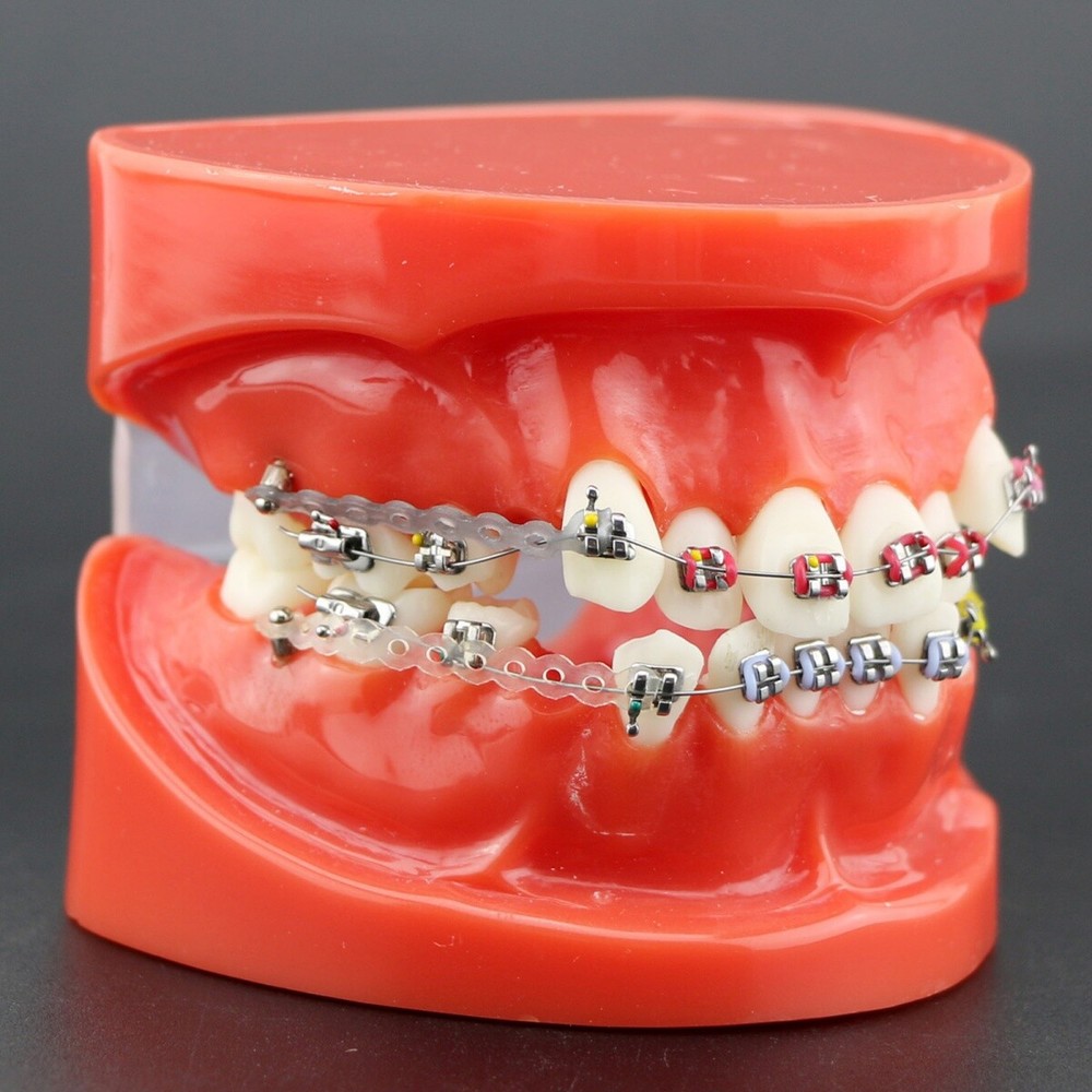 Dental Teeth Teaching Model Orthodontic Model Metal Arch Ceramic Brackets