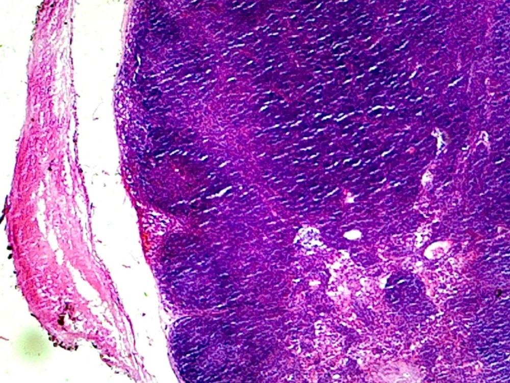 Lymph Node, Mammalian; Section