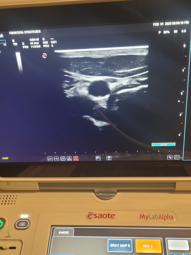 Esaote AL 2442 Linear Array Ultrasound Transducer