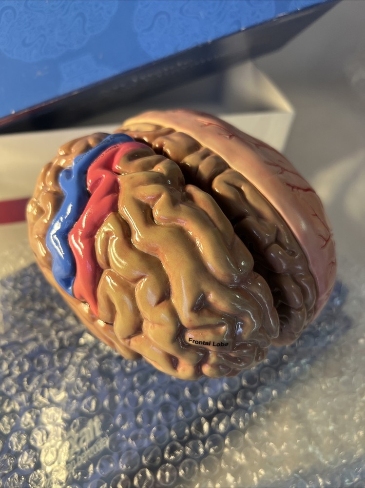 3-D Maxalt Merck An Inside Look At Migraine Teaching Tool