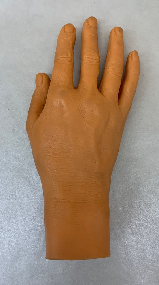 MicroAire 81014 SmartRelease Carpal Tunnel System w/ Hands, Endoscope & More