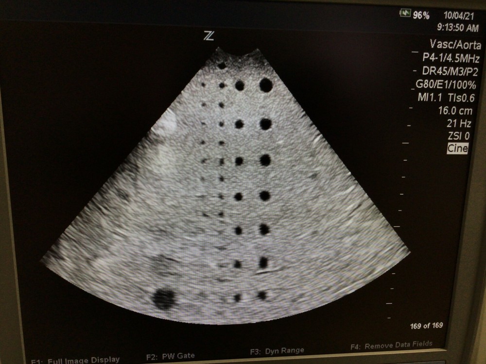 Zonare P4-1 Phased Array Ultrasound Probe -84005
