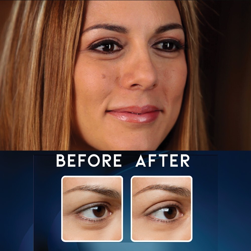 Butterfly Invisible Double Lift Instant Eye Lift