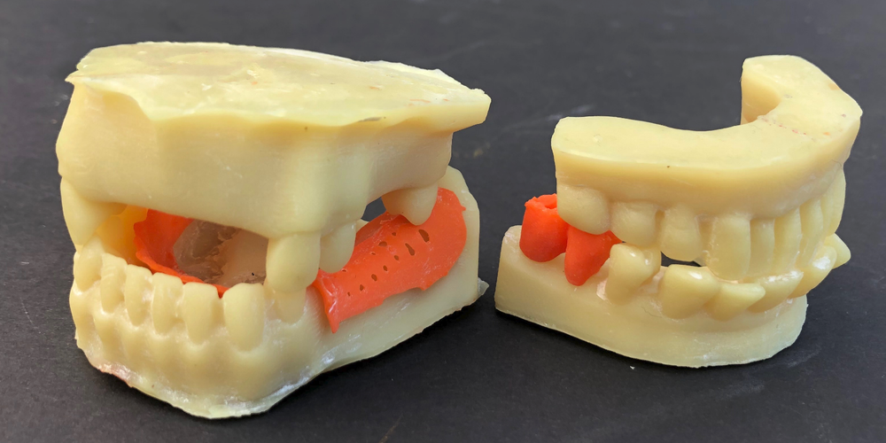 ALPHASENSE 3D DENTAL MODEL RESIN (500 ML)