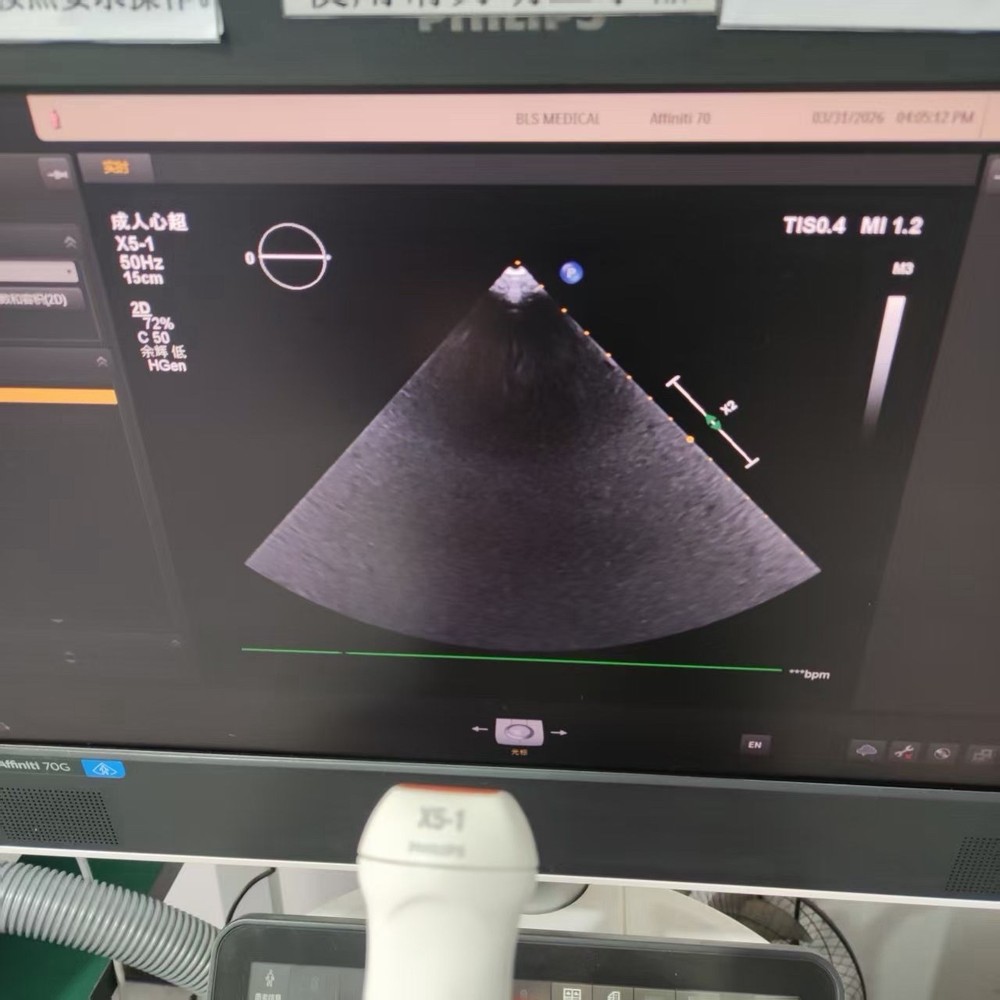 Philips X5-1 Epiq