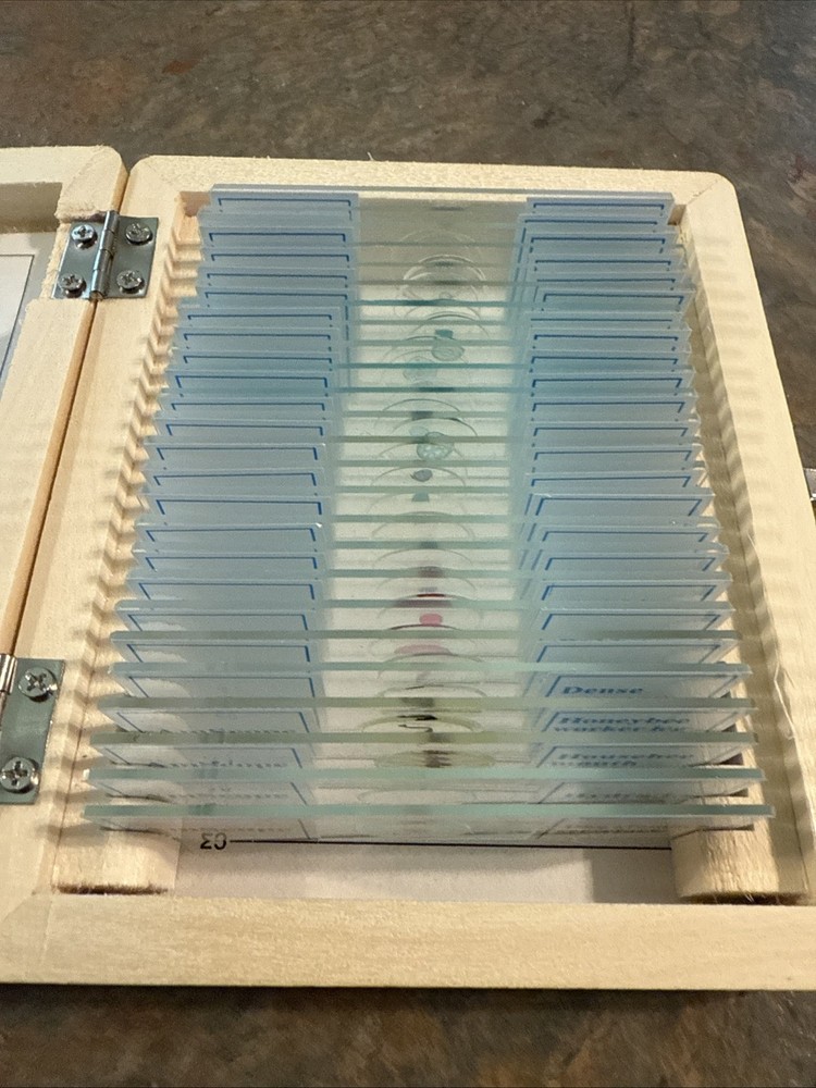 AmScope 25 Prepared Microscope Slide Set for Basic Biological Science