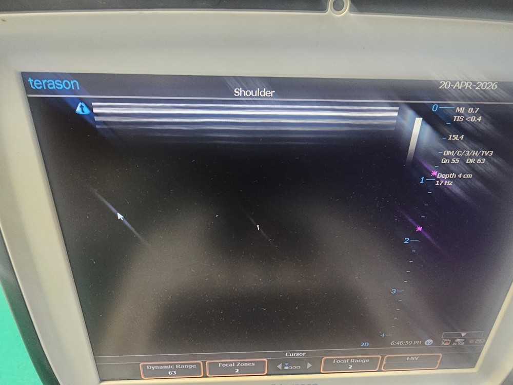 Terason 15L4 Smart Mark Linear Array Transducer For 3300